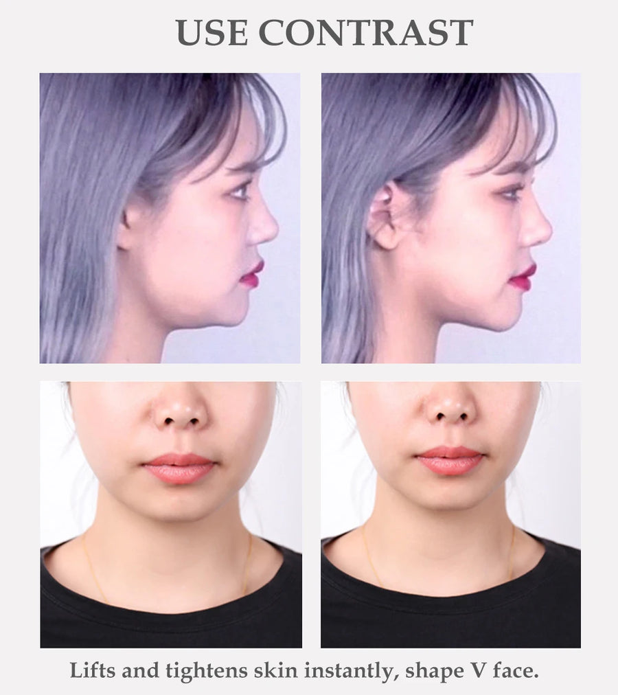 Supplier before and after photos of a jawline, labeled use contrast