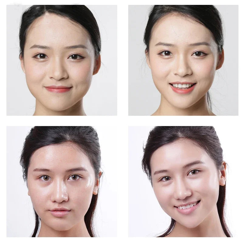 Supplier before and after photos of a woman's face