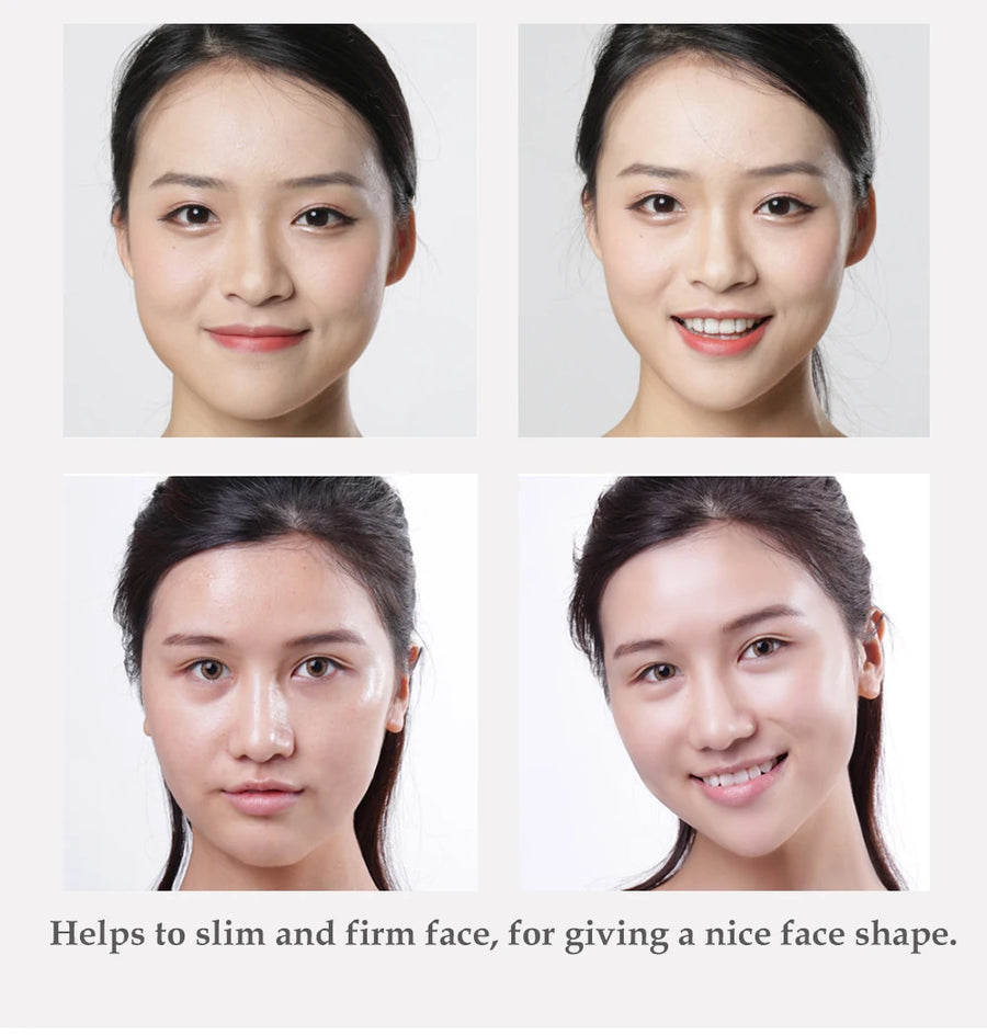 Supplier before and after photos of a woman's face