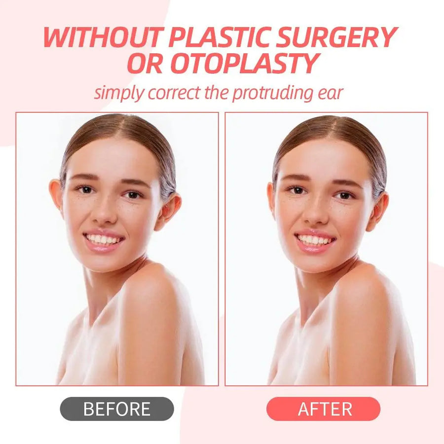 Before and after comparison photos of a woman showing ear position with text about correcting protruding ears without surgery