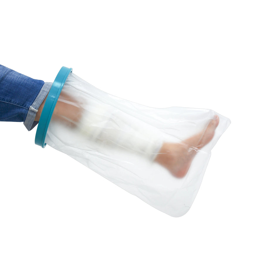 Bandaged lower leg inside the clear cast cover, sealed with the blue ring